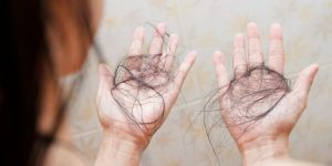 5 Cara Mengatasi Rambut Rontok Secara Ampuh